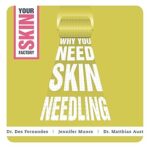 Why You Need Skin Needling